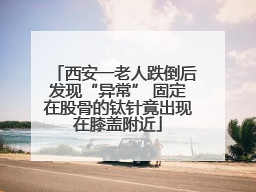 西安一老人跌倒后发现“异常” 固定在股骨的钛针竟出现在膝盖附近